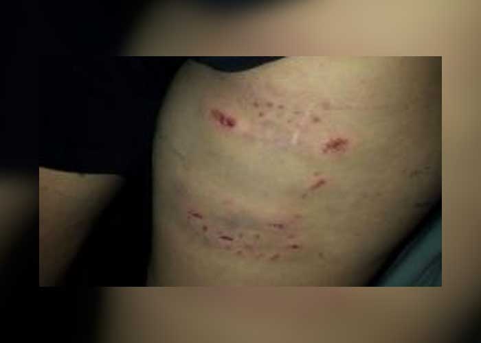 Corinto: Mujeres fueron atacadas por dos feroces pit bull - TN8 el canal joven de Nicaragua