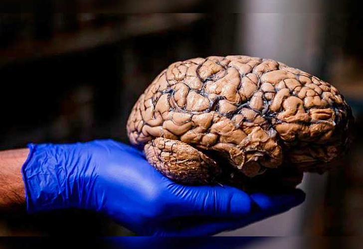 brain coconut, George Paksinoos, human body, brain,
