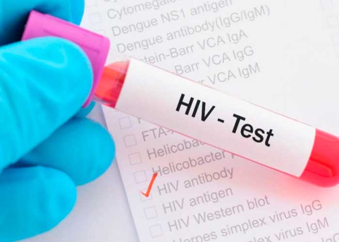 VIH-1 subtipo L, ciencia, nueva cepa, vih, reconocimiento, pacientes, afectaciones