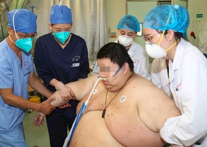 china, sobrepeso, zhou, pandemia, coronavirus, 