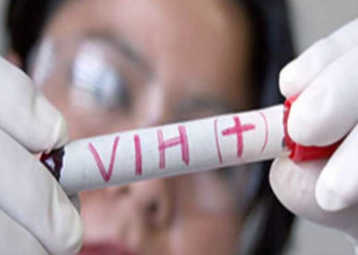 casos de VIH bajan en Australia