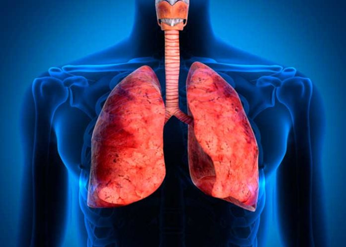acumulacion de liquido en pulmones