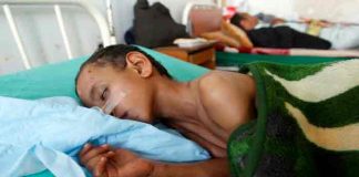 Brote de cólera en Nigeria suma 749 muertes