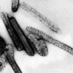 Guinea detecta posible caso de fiebre de Marburgo, similar al ébola