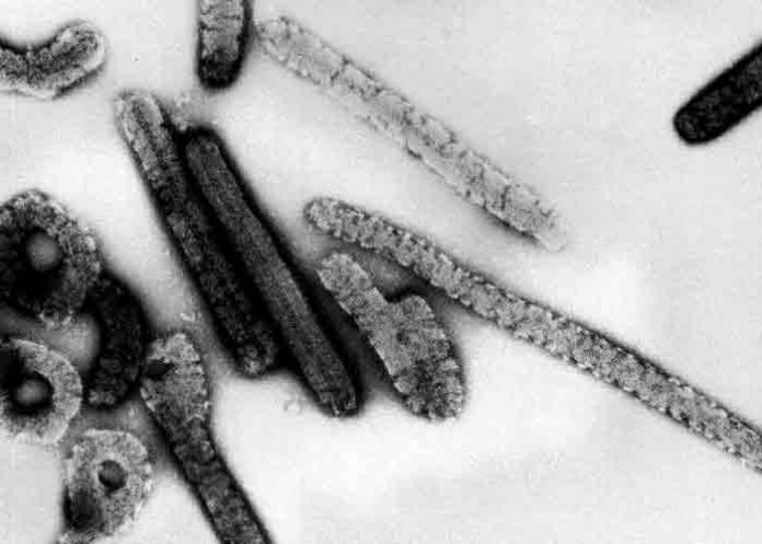 Guinea detecta posible caso de fiebre de Marburgo, similar al ébola