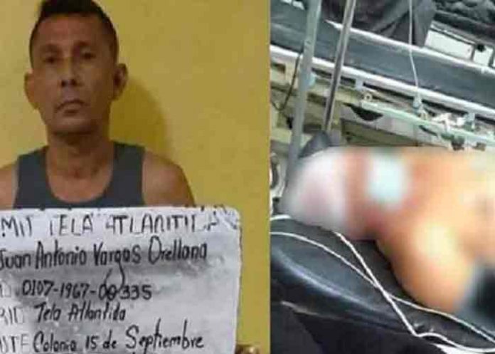 Expastor evangélico machetea a taxista que enamoró a su mujer, Honduras