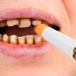¿Cómo afecta el cigarro a la salud de los dientes?