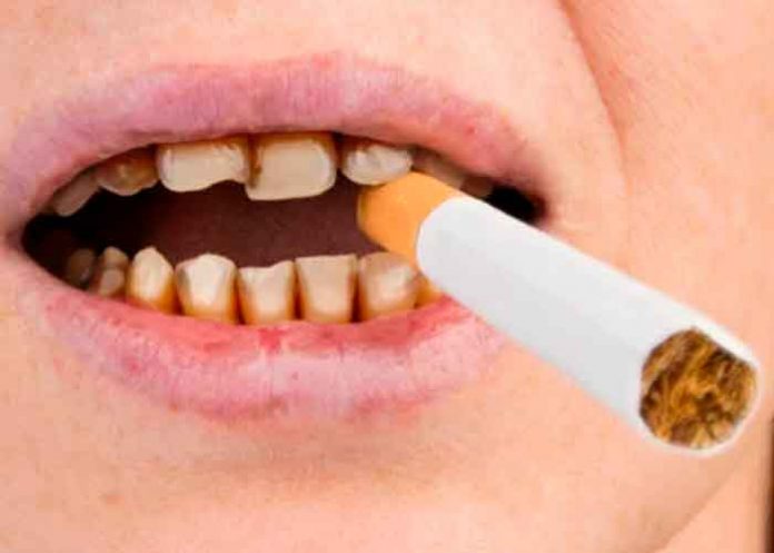 ¿Cómo afecta el cigarro a la salud de los dientes?