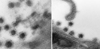 Así se ve la variante Delta del coronavirus a través de un microscopio