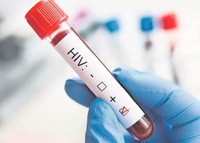 OMS se muestra preocupada por aumento de infecciones de VIH en Europa