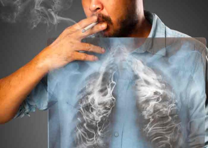 El humo de leña causa el 35 % de los casos de cáncer de pulmón en México