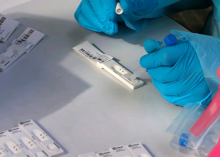 Laboratorio Roche lanza un test para diferenciar el COVID-19 de la gripe