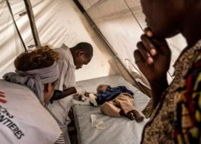  Reportan nuevo brote de cólera en la República Democrática del Congo
