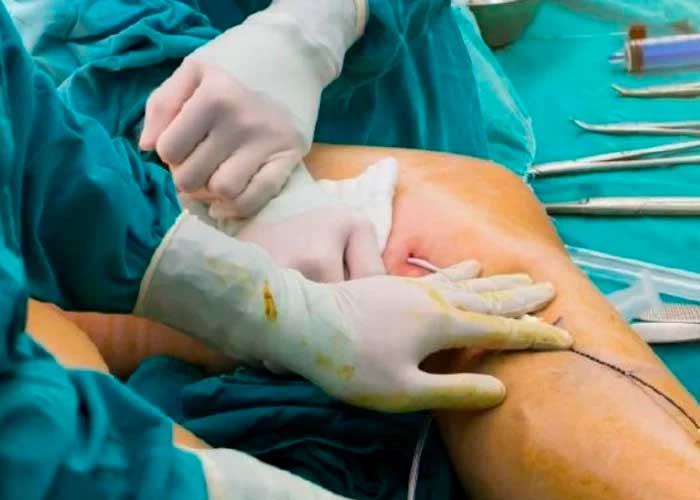 Condenan cirujana en Austria por amputar pierna equivocada a paciente