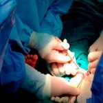 Condenan cirujana en Austria por amputar pierna equivocada a paciente