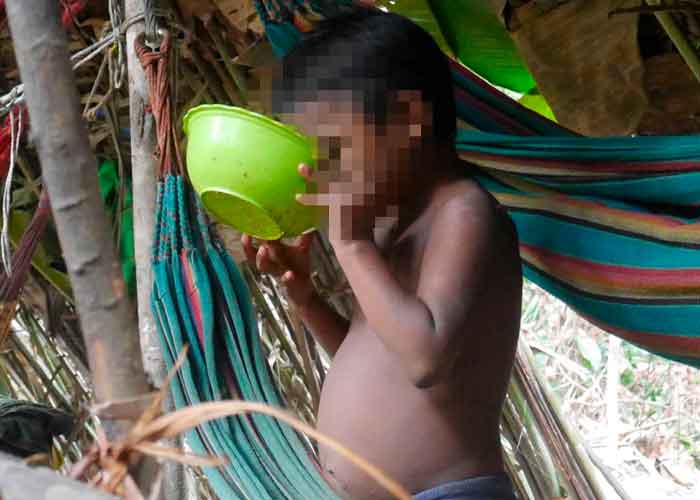 Alarmantes niveles de desnutrición en medio millón de niños en Colombia