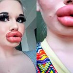 Mujer con los labios más grandes del mundo quiere parecerse a una Bratz