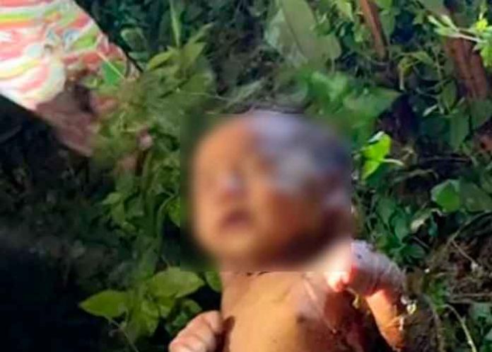 ¡Milagro! Bebé abandonada en un bosque de tailandia sobrevivo a picaduras