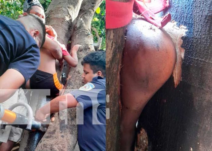 Managua: Bomberos rescatan a niño que quedó prensado entre dos árboles 