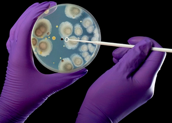 Descubren bacterias, hongos y virus desconocidos en la piel humana