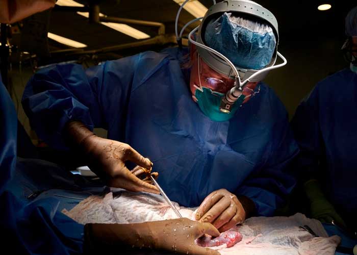 Médicos realizan primer trasplante de corazón de cerdo a un humano