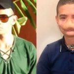 : La historia del joven de Brasil que tiene la cara desfigurada por la pirotecnia