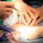 Mujer vivió con tijera quirúrgica dentro del abdomen ¡durante 20 años! en Bangladesh
