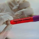 Producen test sanitario para detectar variante Ómicron en Rusia
