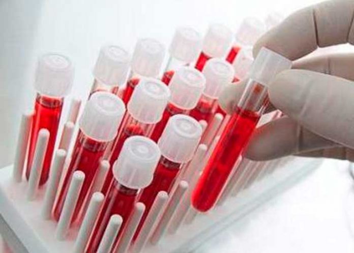 Crean el primer test de sangre capaz de detectar una variedad de cáncer