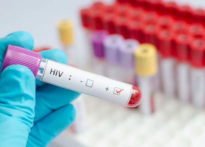 Existe nueva variante más contagiosa del VIH según científicos