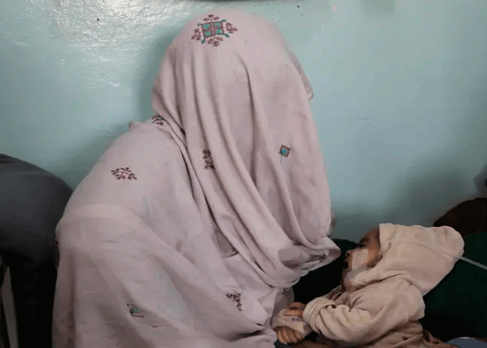 Brote de sarampión deja más de 150 muertos en Afganistán