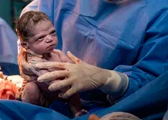La bebé más enojada del mundo se reencuentra con fotógrafo que la hizo viral
