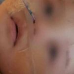 Niñera acusada de fracturar el cráneo de bebé porque “no dejaba de llorar”