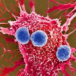 Brasil autoriza primer tratamiento génico CAR-T contra el cáncer