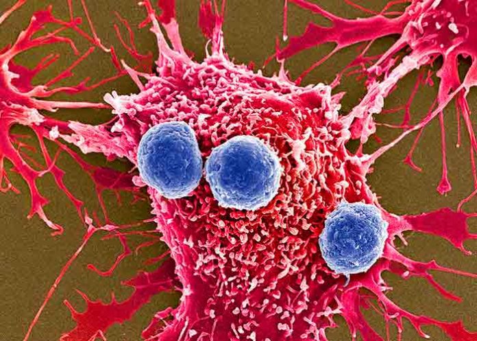Brasil autoriza primer tratamiento génico CAR-T contra el cáncer