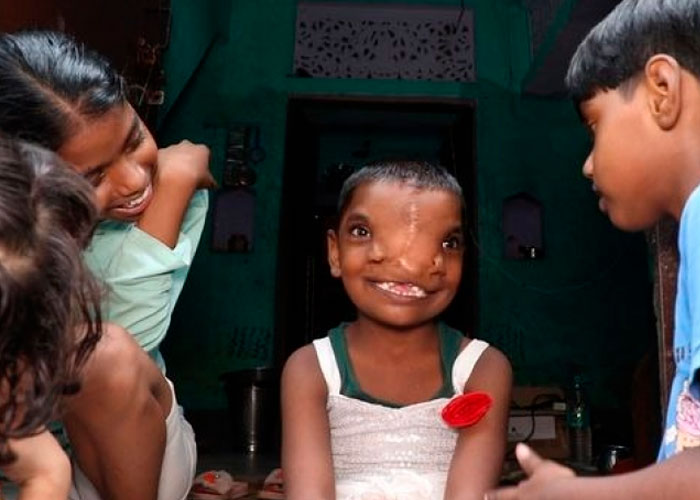 Inusual apariencia de una niña causa temor en la India