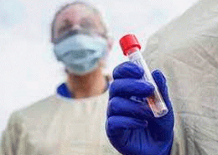 Reportan casos de fiebre de Lassa en Reino Unido, virus similar al ébola