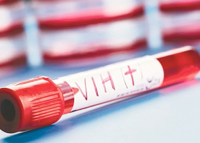 ¿La cura del VIH? Novedoso tratamiento con sangre parece efectivo