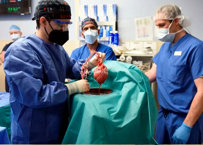 Muere en EEUU el primer paciente que recibió trasplante de corazón de cerdo.