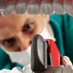 Dentista culpable de haber dañado dientes a miles de pacientes en EE.UU