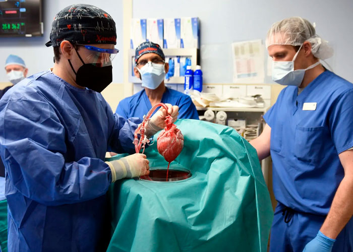 ¿Qué pasó? Murió el primer paciente que le trasplantaron corazón de cerdo