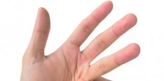 ¿Es bueno o dañino para la salud “tronarse” los dedos?