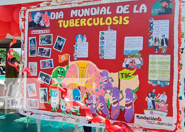 Encuentro con pacientes con tuberculosis en Nicaragua