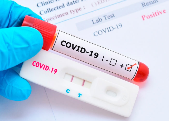 Autorizan prueba de aliento que detecta el COVID-19