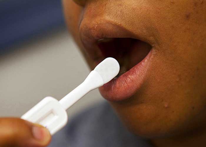 El VIH se va poder detectar por medio de la saliva
