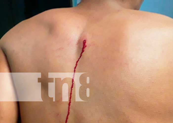 Herido por hecho sangriento en El Cuá, Jinotega