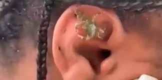El surrealista momento en que un cangrejo sale del oído de una joven