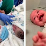 Bebé australiana nace con síndrome de "sonrisa permanente"