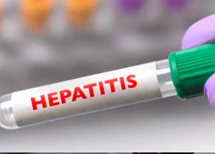 OMS informa un incremento en casos de hepatitis aguda infanti