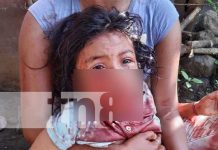 Pitbull ataca a una niña en Chichigalpa, Chinandega